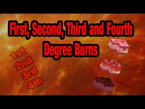 How To Grade BURNS - 1st, 2nd, 3rd and 4th Degree Burns Explained