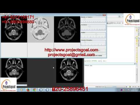 Fuzzy Local Gaussian Mixture Model for Brain MR Image Segmentation