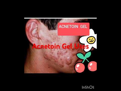 Acnetoin Gel Uses