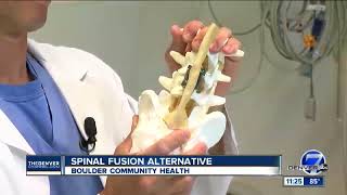 Spinal Fusion Alternative