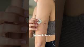 Removendo meu sensor FreeStyle Libre #diabetes #diabetestipo1 #dm1 #youtubeshorts #glicemia #sensor
