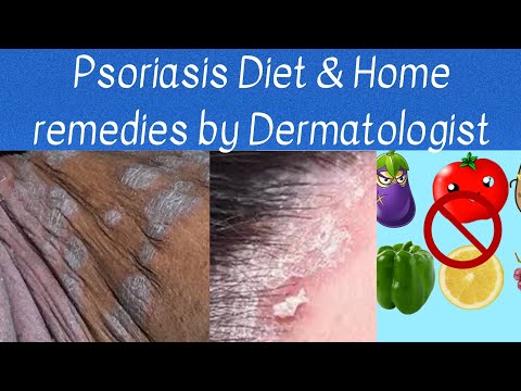 Psoriasis diet and home remedies by Dermatologist/ what foods to eat and what not to eat/