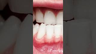 The Benefits of Getting a Regular Dental Cleaning | #doctor #unitedstates #tiktok