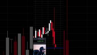 LIVE TRADE — $7,300 PROFIT SNIPED 🎯🦅 #livetrading #milliondollartrading #learningtotrade