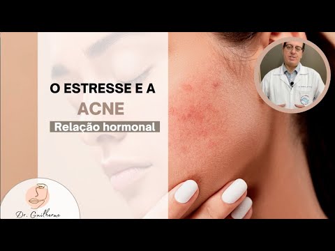 O estresse e a acne - Qual a relação?