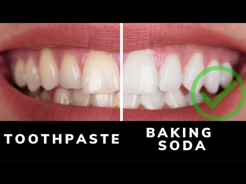how to whiten teeth using baking soda