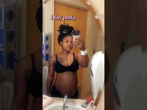 1 day postpartum VS 5 months #postpartum #pregnant #fitness #motivation #weightlossjourney