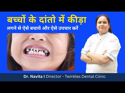 बच्चों के दांतो में कीड़ा लगने से कैसे बचाए? I बच्चों के दांतो मैं लगे हुए हुए कीड़े को कैसे हटाएं?
