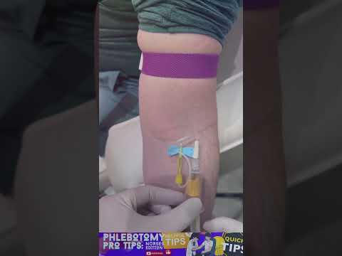 Watch Me Nail This IV 💉 (No Hesitation. No Misses.)