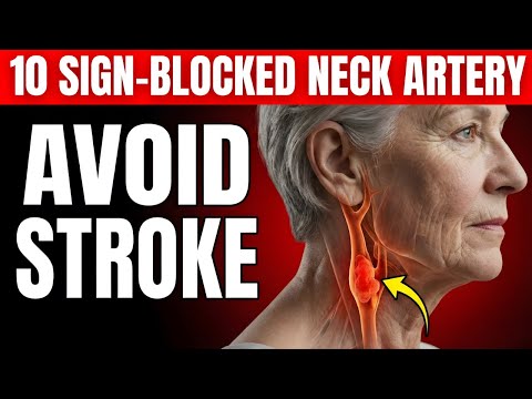 SENIORS! 10 WARNING Signs of BLOCKED Arteries in Your NECK That Cause a Stroke (Don't Ignore #5)