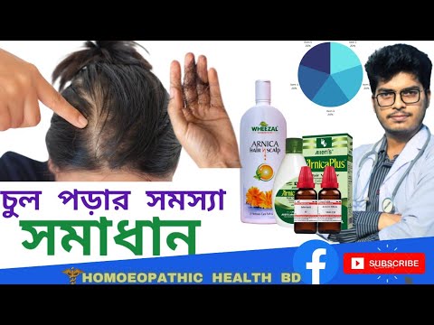 চুল পড়ার সমস্যা ও সমাধান। Part 1 (only for female) Hair loss treatment ঘরোয়া  সমাধান