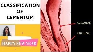 CEMENTUM ( PART II) II Classification of Cementum