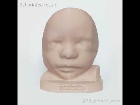 Ultrasound to 3D Printing.