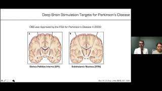 Deep Brain Stimulation for Movement Disorders