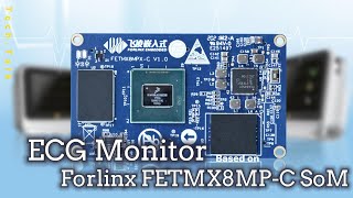 Application of Forlinx  NXP iMX8MP-C SoM in ECG Monitor