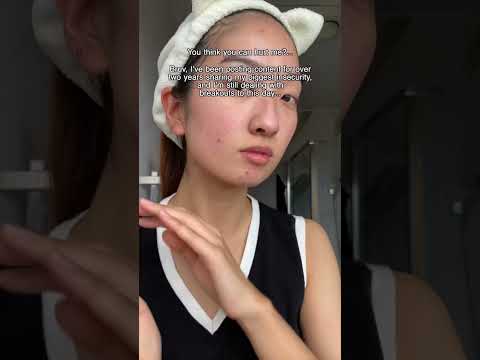 You think you can hurt meh…? I’ve been posting about my biggest insecurity for over 2 years! #acne
