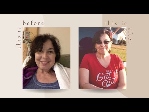Before & After Colectomy | IBD | Meet Ripley the #Stoma | #Shorts