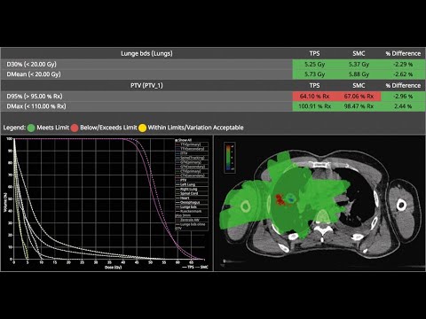 Monte Carlo Patient QA - SciMoCa Software Demo