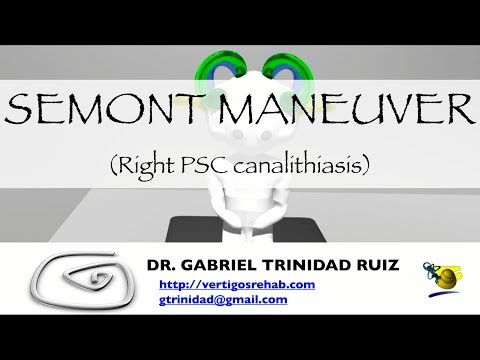 SEMONT MANEUVER RIGHT PSC