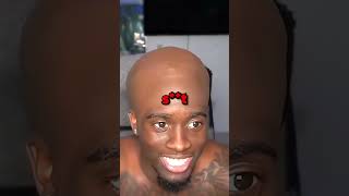 Streamers With Giant Foreheads 🧠
