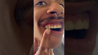 WILL DIRTY’S TOOTH FALL OUT?               #stillsaggin #tour #disrespectboyz #dirtydapper