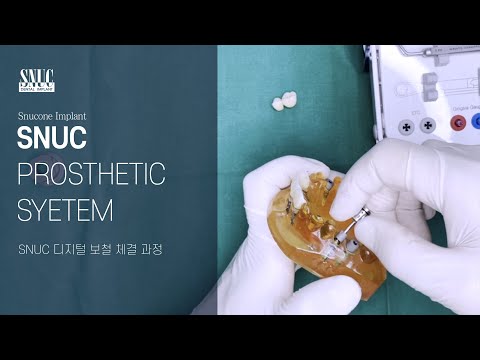[Snucone Implant] SNUC Prosthetic System SNUC디지털 보철 체결영상