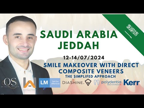 Smile makeover with composite veneers course - participants opinions