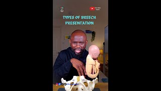 The MUST KNOW Types of Breech Presentation - Malpresentation