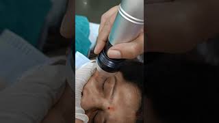 Dark circles treatment by MNRF technology.. Message me  99908 04088.