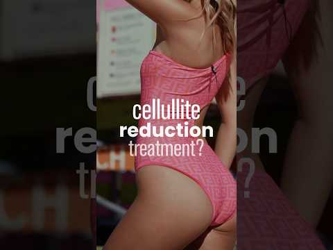 Cellulite treatments actually work?? 🍊cellulite machines