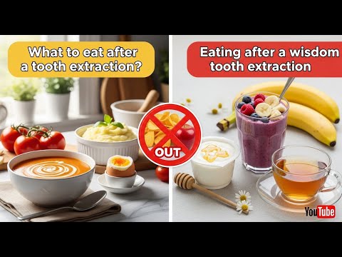 What to eat after a tooth extraction? / Eating after a wisdom tooth extraction