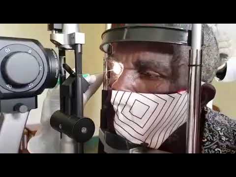 Corneal scrape 'how to' video