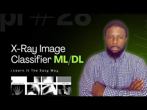 X-Ray Image Classification — Machine Learning Made Easy!