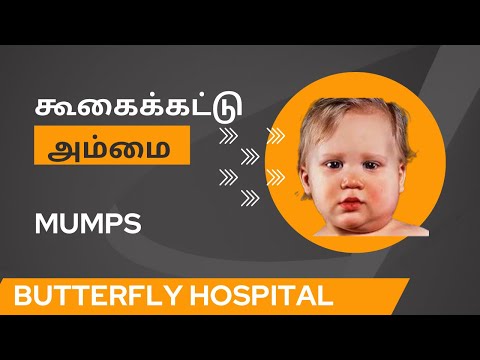 உங்கள் குழந்தைக்கு கூகைக்கட்டு #அம்மைநோய் உள்ளதா Does Your Child Have #mumps #ammai #childcare #pain