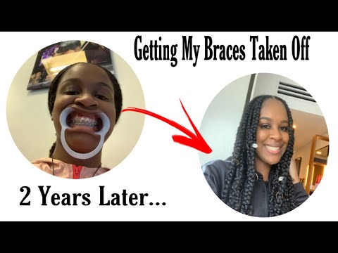 Finally Getting My Braces Taken Off 😁🤗 (BE WARE *It Gets Bloody*🥴)