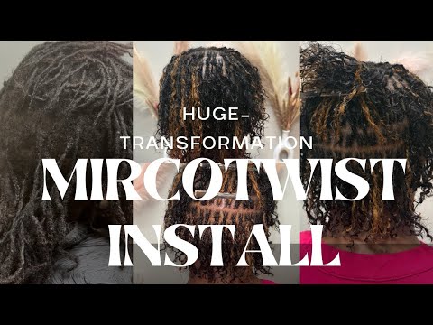 MIRCOTWIST INSTALL | POST PARTUM & TRACTION ALOPECIA REPAIR