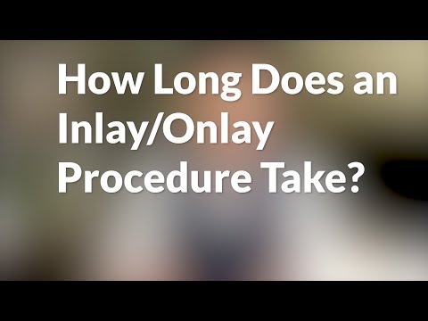 How Long Does an Inlay/Onlay Procedure Take?