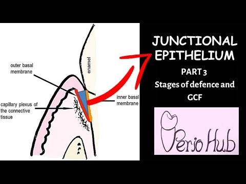 JUNCTIONAL EPITHELIUM (PART 3) II Stages of defence and GCF