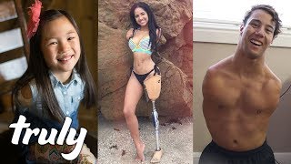 Living Without Limbs | TRULY
