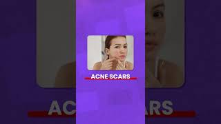 How to deal with pigmentation? #pigmentationsolution