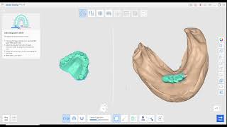 MEDIT LINK FOR FIXING FILE ALIGMENT EDITING AND MODEL BUILDING