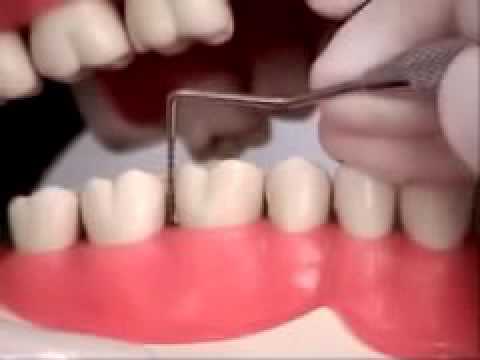 02Video Probing Posteriors