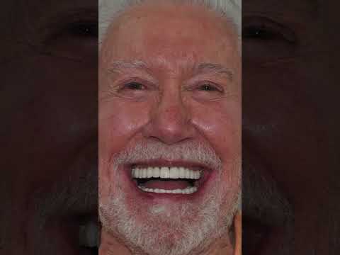 Watch this full mouth porcelain restoration (Dr. Johana Ossa, Medellin Dentist)