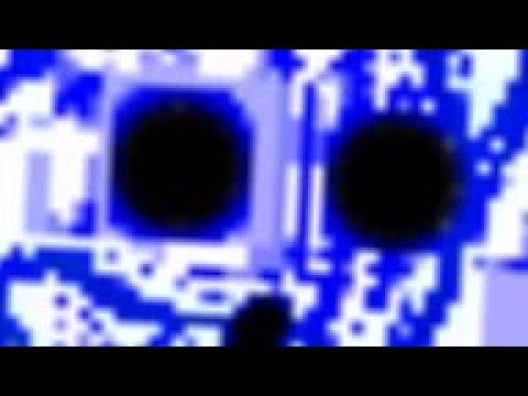 Pain