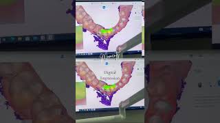 #digitalimpression