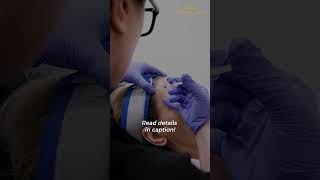 3 Factors That Can Impact the Longevity of Botox | Dr. Mitra Amiri | Wrinkles | Derma Arts #shorts