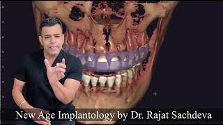STOP Wasting Money on Dental Implants Until You Watch This!