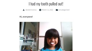 First Tooth Fall Out!