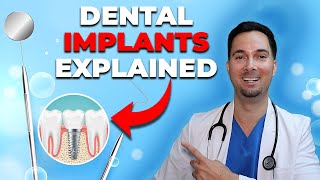 Dental implant procedure (simple guide)