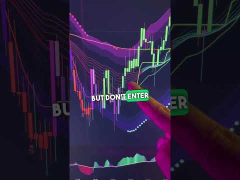 🔴 Trade Nasdaq like a BOSS! #forex #daytrading #daytrader #stocks #forextrading